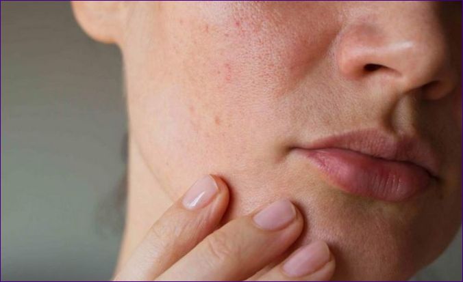 3 tipy a 4 řešení proti běžnému podráždění pokožky